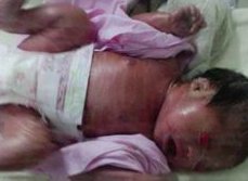 重度宫腔粘连在福泉市做试管婴儿靠谱吗，重度宫腔粘连试管婴儿成功率多少！