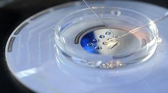 山东三代试管技术怎么样？如何提高试管成功率？